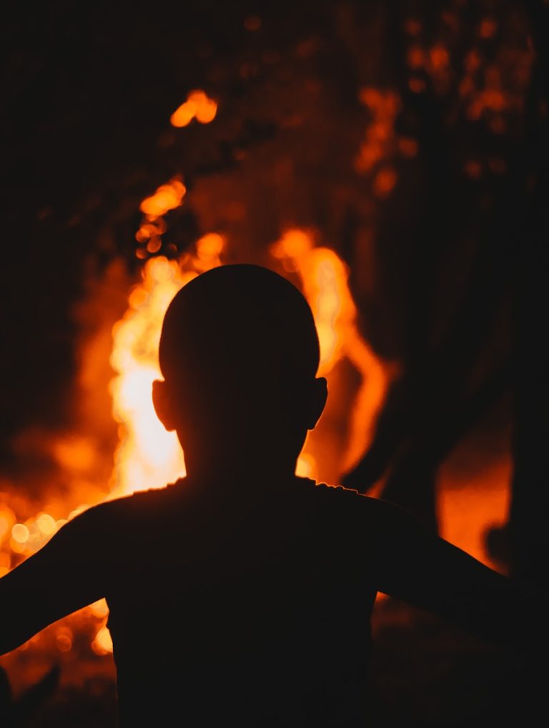 Teen Burning Case 2 Men Sentenced Over Shocking Dagga Theft Crime Teen Burning Case victim and family trauma
